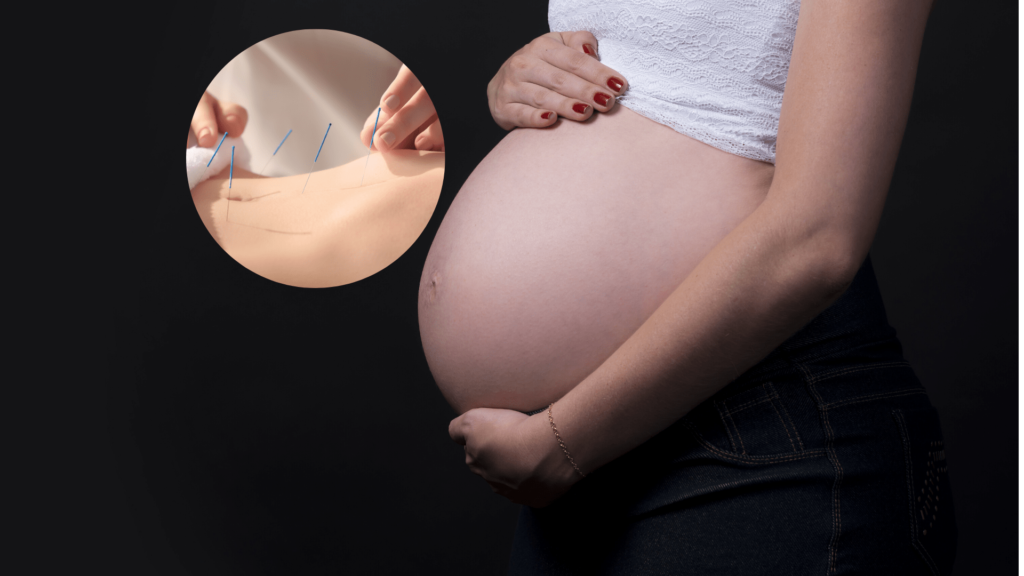 acupuntura para fertilidad