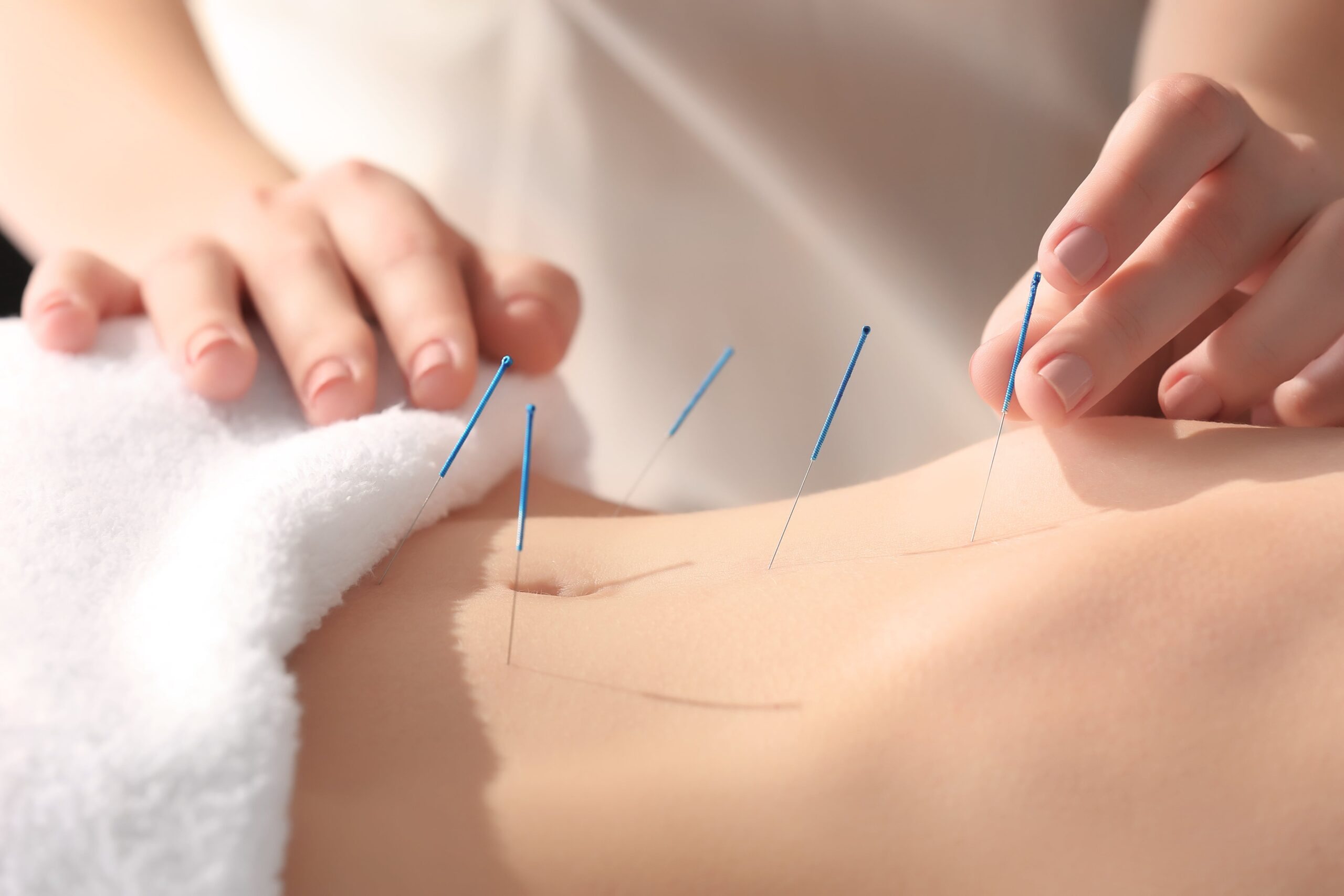 acupuntura para fertilidad
